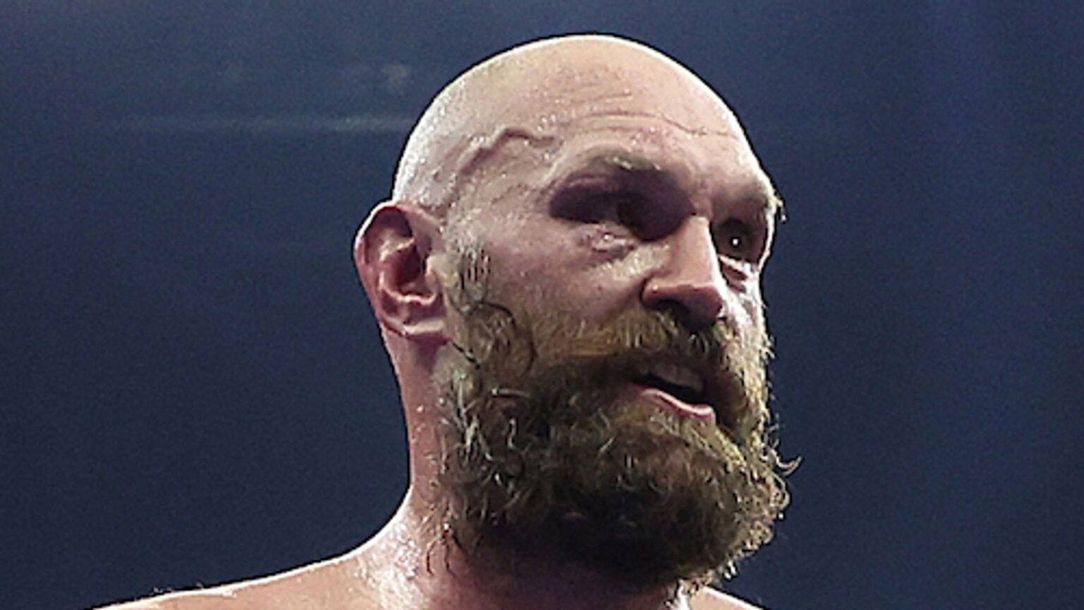 Skysports tyson fury oleksandr 6783005.jpg