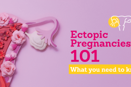 Ectopic pregnancies2.png