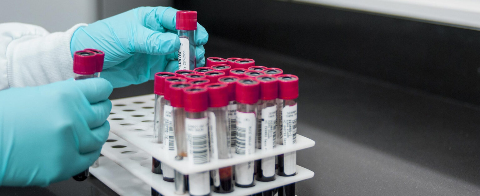 Who eul mpox test kits news banner.jpg
