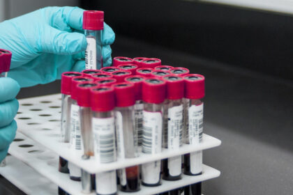 Who eul mpox test kits news banner.jpg