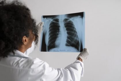 Side view doctor looking radiography 1024x683.jpg