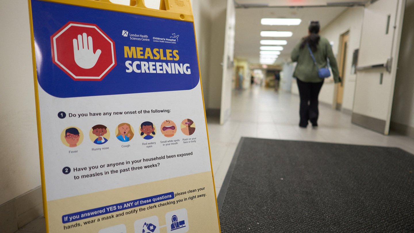 112425 EG measles feat.jpg