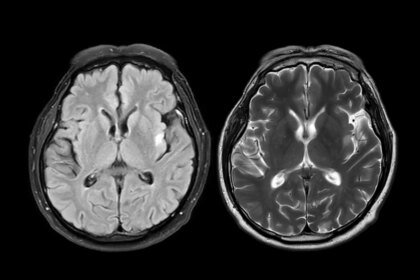 Pandemic brain age lead image.jpg